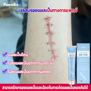 Puweikeเจลทารอยแผลเป็น20g กำจัดรอยแตกลาย แผลไฟไหม้  ครีมทารอยสิว แผลผ่าตัด ครีมทารอยแผลเป็น ครีมลบแผลเป็น ยาลบลอยแผลเป็น