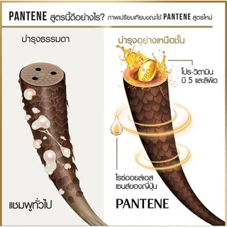 แชมพูเคลียร์ เมน แชมพู pantene ผมร่วง เสีย clear คลูสปอตเมลทัล แชมพูขจัดรังแค ขนาด 60/70 ml