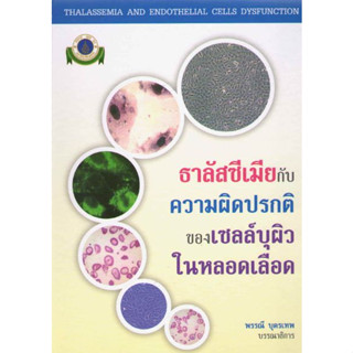 [หนังสือ] ธาลัสซีเมียกับความผิดปรกติของเซลล์บุผิวในหลอดเลือด thalassemia โรคเลือด โลหิตวิทยา hematology อายุรศาสตร์