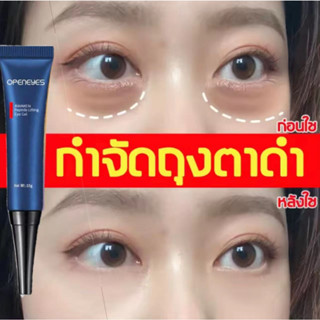 OPENEYES อายครีม 15g ครีมลบถุงใต้ตา กระชับ ยกกระชับ ลดรอยคล้…