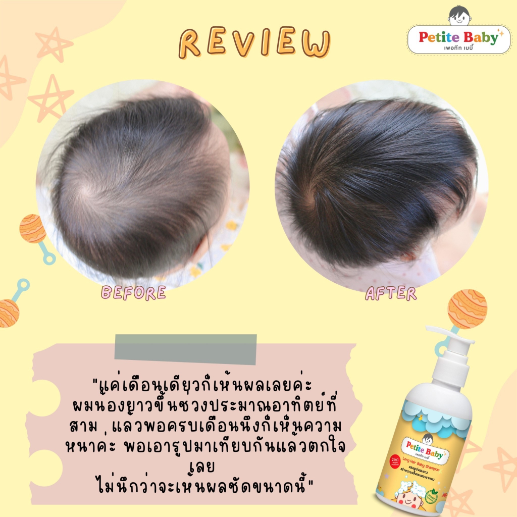 แพคคู่สุดคุ้ม ซือคู่ถูกกว่า 2 ขวด - รูปที่ 2