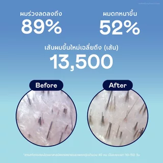 DIVYNE Clear Cloud Hair Shampoo 310ml แชมพูลดผมร่วง ผมบาง ขาดง่าย ปรับสมดุลหนังศีรษะ