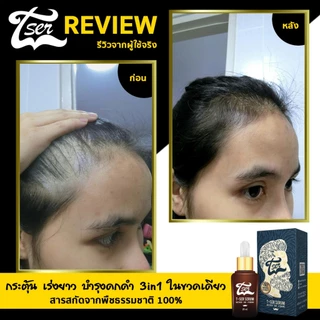 [ส่งฟรี] เซรั่มปลูกคิ้ว T-Ser บำรุงขนคิ้ว ที่ปลูกคิ้วดก น้ำยาปลูกคิ้ว (2ขวด)