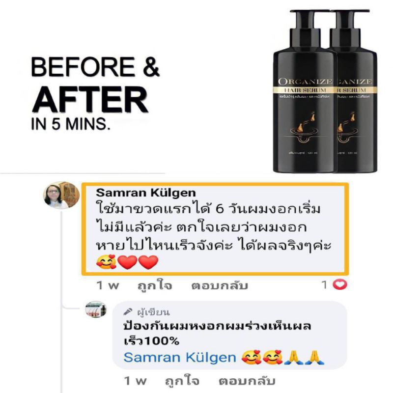 เซรั่มแก้ผมหงอก ป้องกันผมร่วง - รูปที่ 7