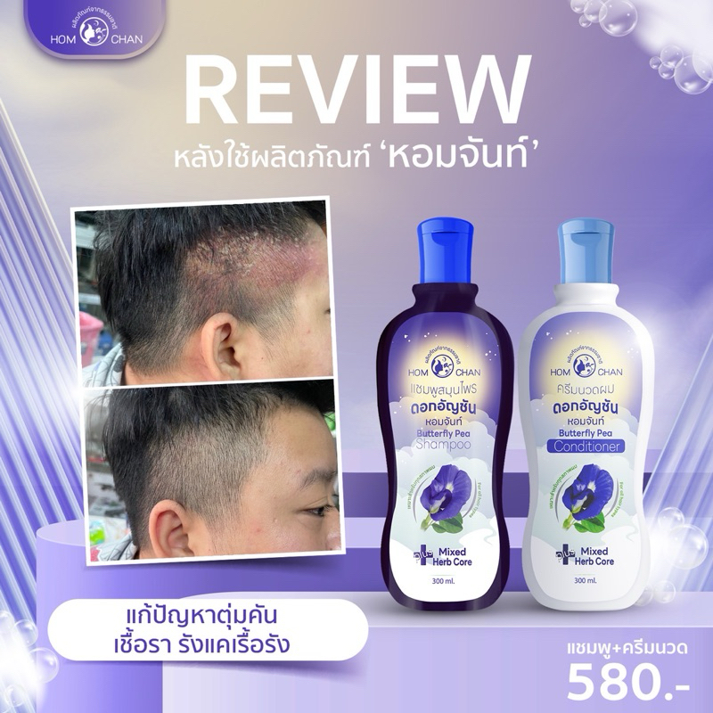 แชมพูสมุนไพรหอมจันท์ 290.- กลากเกลื้อน หนังศีรษะลอก ตุ่มคัน เชื้อรา รังแค ลดปัญหาผมร่วง