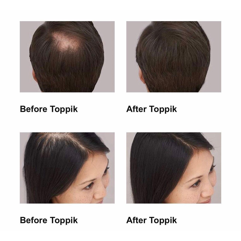 💋ส่งToppikแน่นอน 💋 สีดำ ผงไฟเบอร์ปิดผมบาง ผงไฟเบอร์ ผงโรยผม ผงไฟเบอร์ผม ผงโรยผมหนา ผงไฟเบอร์ใส่ผม - รูปที่ 2