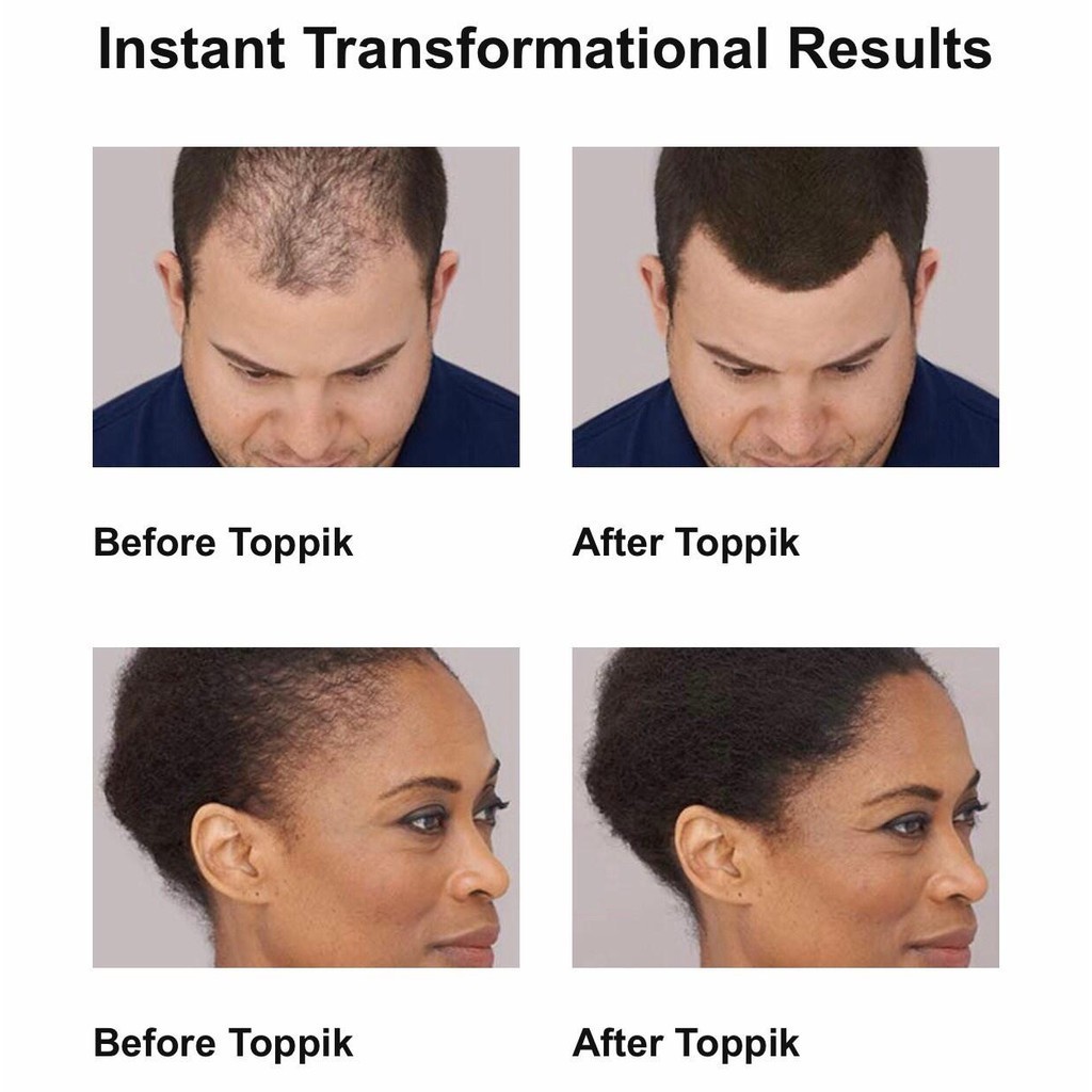 💋ส่งToppikแน่นอน 💋 สีดำ ผงไฟเบอร์ปิดผมบาง ผงไฟเบอร์ ผงโรยผม ผงไฟเบอร์ผม ผงโรยผมหนา ผงไฟเบอร์ใส่ผม - รูปที่ 3