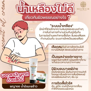 โลชั่นพญายอ น้ำมันมะพร้าวสกัดเย็น ผื่นคัน เกา สะเก็ดเงิน แพ้เหงื่อตัวเอง ขนาด 100 ml