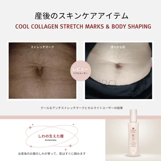 COCORO TOKYO - เซ็ทคู่ลดรอยแตกแดง และแตกขาว ลดเหี่ยวย่น ลดเซลลูไลท์ - ขนาด 120 ml.