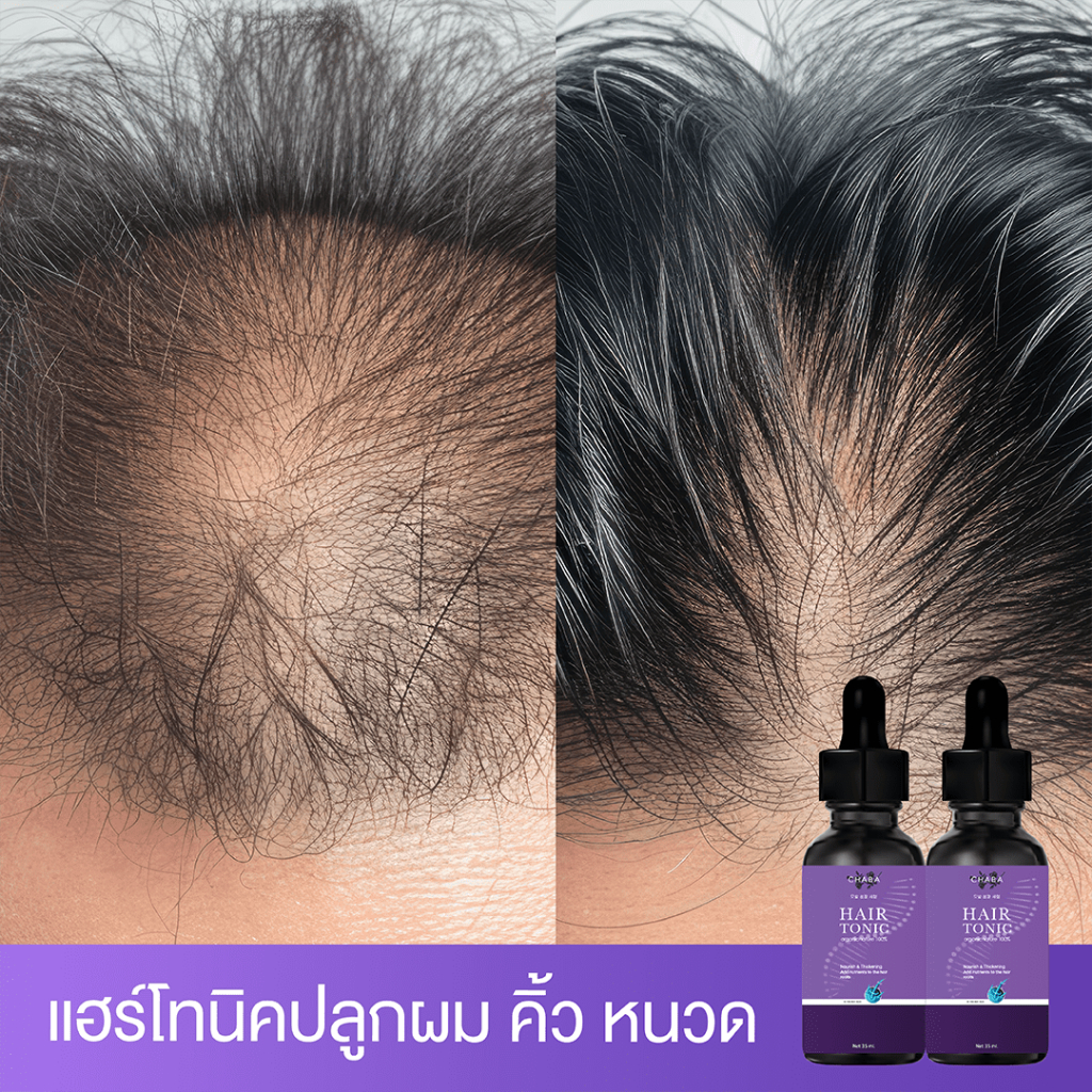 เซรั่มลดผมร่วง ปลูกผม ปลูกคิ้ว ปลูกหนวด ผมยาวไว 1แถม1 โทนิคชบาสูตรเข้มข้นขึ้นเร็ว ของแท้ 100
