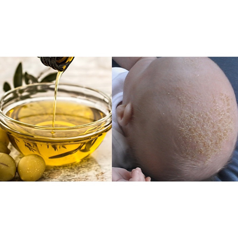 น้ำมันมะกอกบริสุทธิ์ Noah สำหรับเด็ก👶🏻👶🏻 100% Extra virgin olive oil for kids low Acidity(250ml) - รูปที่ 7