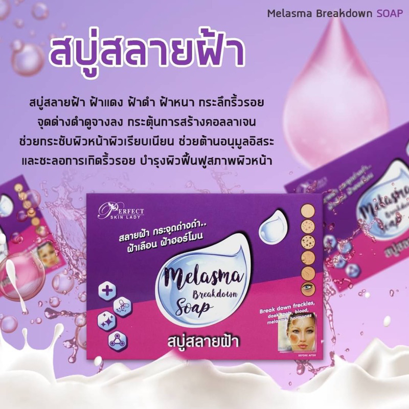 สบู่สลายฝ้า Malasma Soap กล่อง 80g