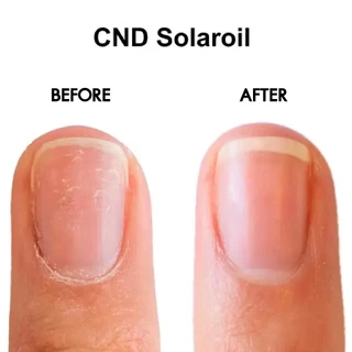 CND Solar oil น้ำมันบำรุงเล็บ และหนังขอบเล็บ น้ำมันบำรุงเล็บ ครอบจักรวาล 3.7ml.