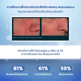 ISDIN Nutradeica® DS Facial Gel Cream เจลครีม ดูแลผิวเซ็บเดิร์มและสิวจากการ ใส่ mask ผิวชุ่มชื้น ปรับสมดุลผิว ลดอาการคัน