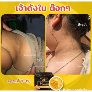ครีมขมิ้นHerbal ครีมขมิ้นเฮอร์เบิล บำรุงใบหน้า ลดรอยดำ คอดำ ขาหนีบดำ จักแร้ดำ (แท้จากบริษัท)