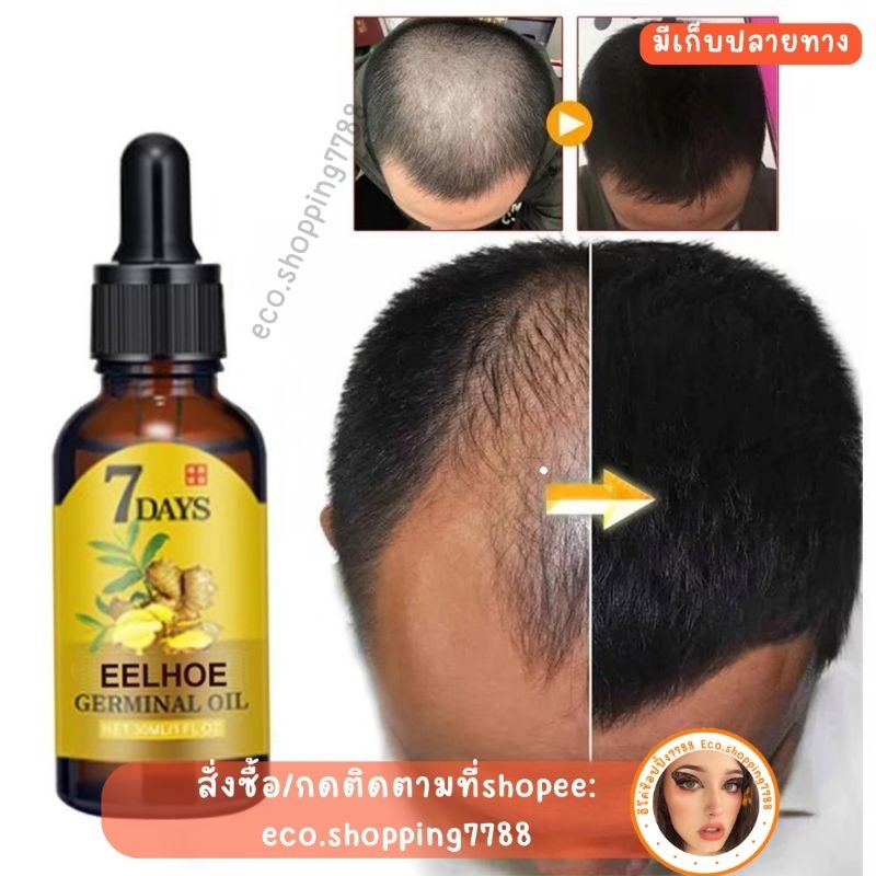 พร้อมส่ง เซรั่มขิง ลดผมร่วง เร่งผมยาว  เซรั่มบำรุงรากผมและหนังศีรษะ 20ml. Hair growth serum