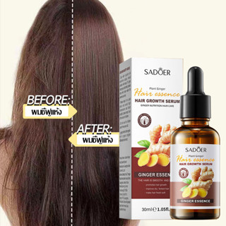 🧴 เซรั่มบำรุงเส้นผม SADOER Htain Essence (สูตรขิง) ขนาด 30 ก…