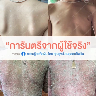 Ze-Oil 300 เม็ด ผลิตภัณฑ์เสริมอาหาร สารสกัดจากน้ำมัน [ทักแชท Code ลด 10%] ซีออยล์โกลด์(Ze-Oil Gold)