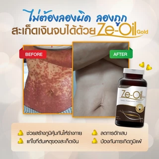 Ze-Oil 300 เม็ด ผลิตภัณฑ์เสริมอาหาร สารสกัดจากน้ำมัน [ทักแชท Code ลด 10%] ซีออยล์โกลด์(Ze-Oil Gold)