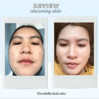 ครีมชาร์มมิ่งสกิน Charming skin (ไนท์ครีมเล็ก ขนาด 10 กรัม) ส่งฟรี