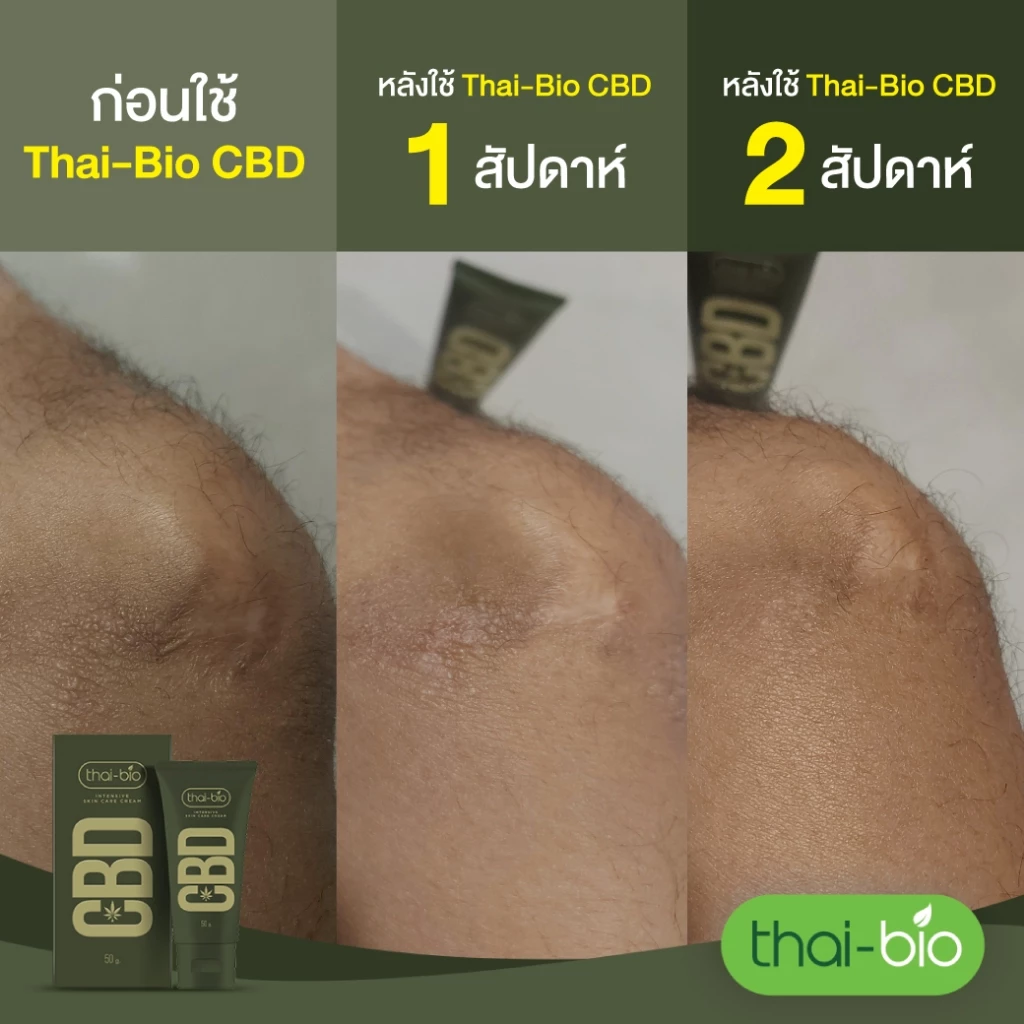 thai bio Intensive Skin Care ครีมทาผิว สกินแค ซีบีดี ครีม  ขนาด 50 g. thumbnail 7
