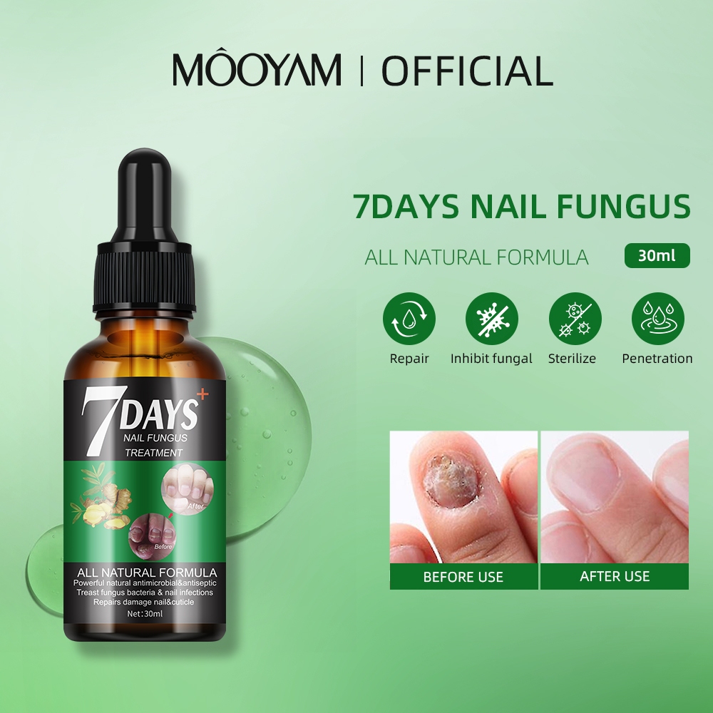 MOOYAM ดูแลเล็บ เซรั่มเล็บ เซรั่มบำรุงเล็บ แก้เชื้อราที่เล็บ บำรุงเล็บ ลากับเล็บเสีย ซ่อมแซมเล็บ Nail Serum 30ml