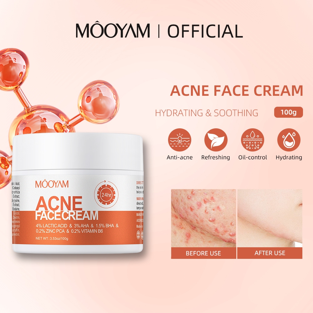 MOOYAM Acne Cream ครีมลดสิวผด Salicylic Acid Acne Treatment ให้รูขุมขนหดตัวควบคุมความมันทำให้ผิวขาวดูแลผิว 30g