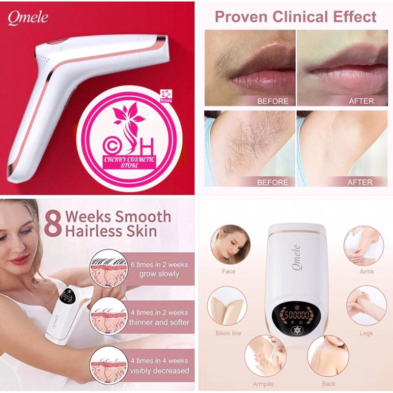 Qmele Ipl machine ( hair removal )