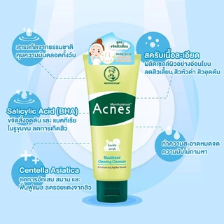 เมนโทลาทั่ม แอคเน่ส์ แบล็คเฮด แอนด์ ออย คอนโทรล วอช 100 กรัม MENTHOLATUM ACNES BLACKHEAD & OIL CONTROLLING WASH 100 G.