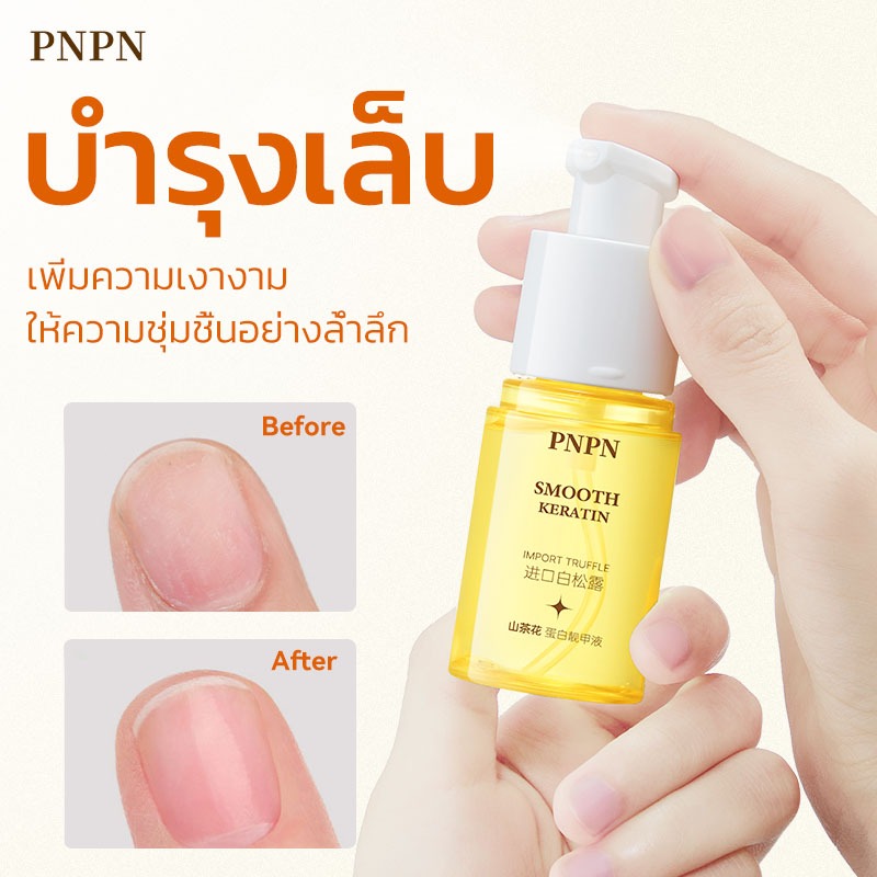 เซรั่มบำรุงเล็บ น้ำยาบำรุงเล็บ 30ml Nail Care บํารุงเล็บ ต่อต้านการติตเชื้อรา ซ่อมแซมเล็บแตก เล็บเปราะ เล็บหนา