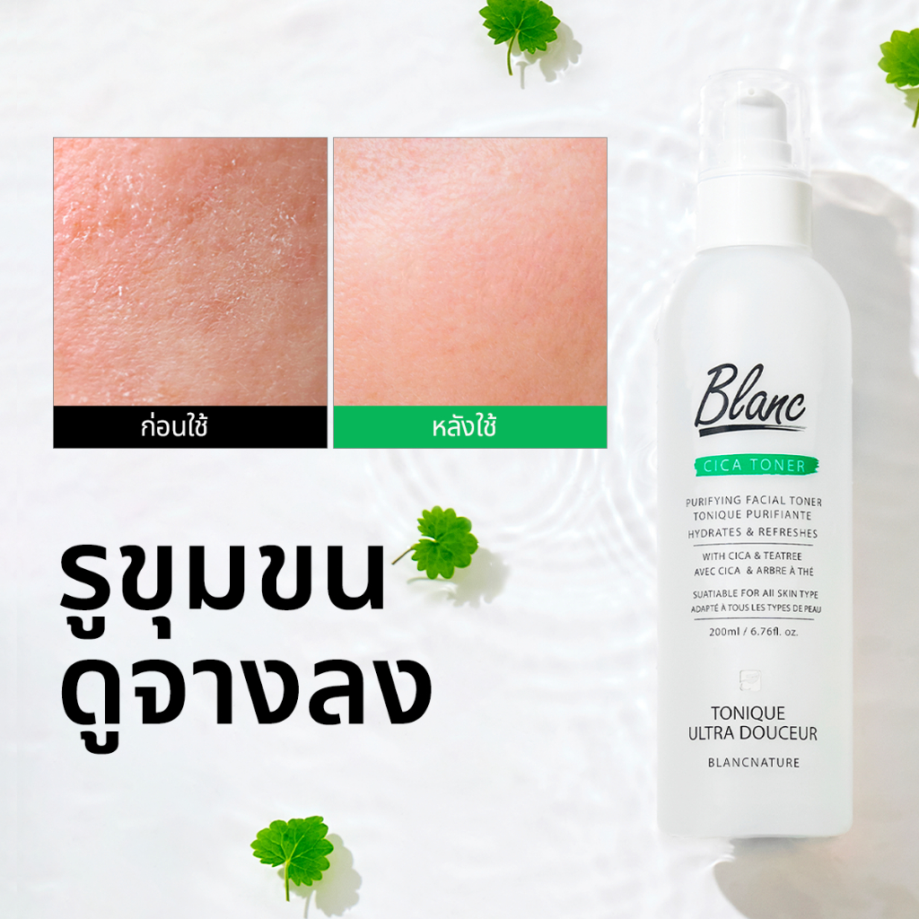 [Blanc Nature Official] โทนเนอร์ลดสิวและกระชับขุมขน *ขายดีอันดับ 1* "ซิก้า โทนเนอร์" สกินแคร์เกาหลี