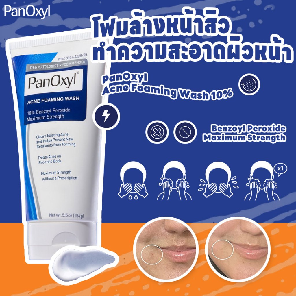 ซื้อ PanOxyl Acne Foaming Wash 10% Benzoyl Peroxide Maximum Strength 156g โฟมล้างหน้า โฟมล้างหน้าสิว ทําความสะอาดผิวหน้า