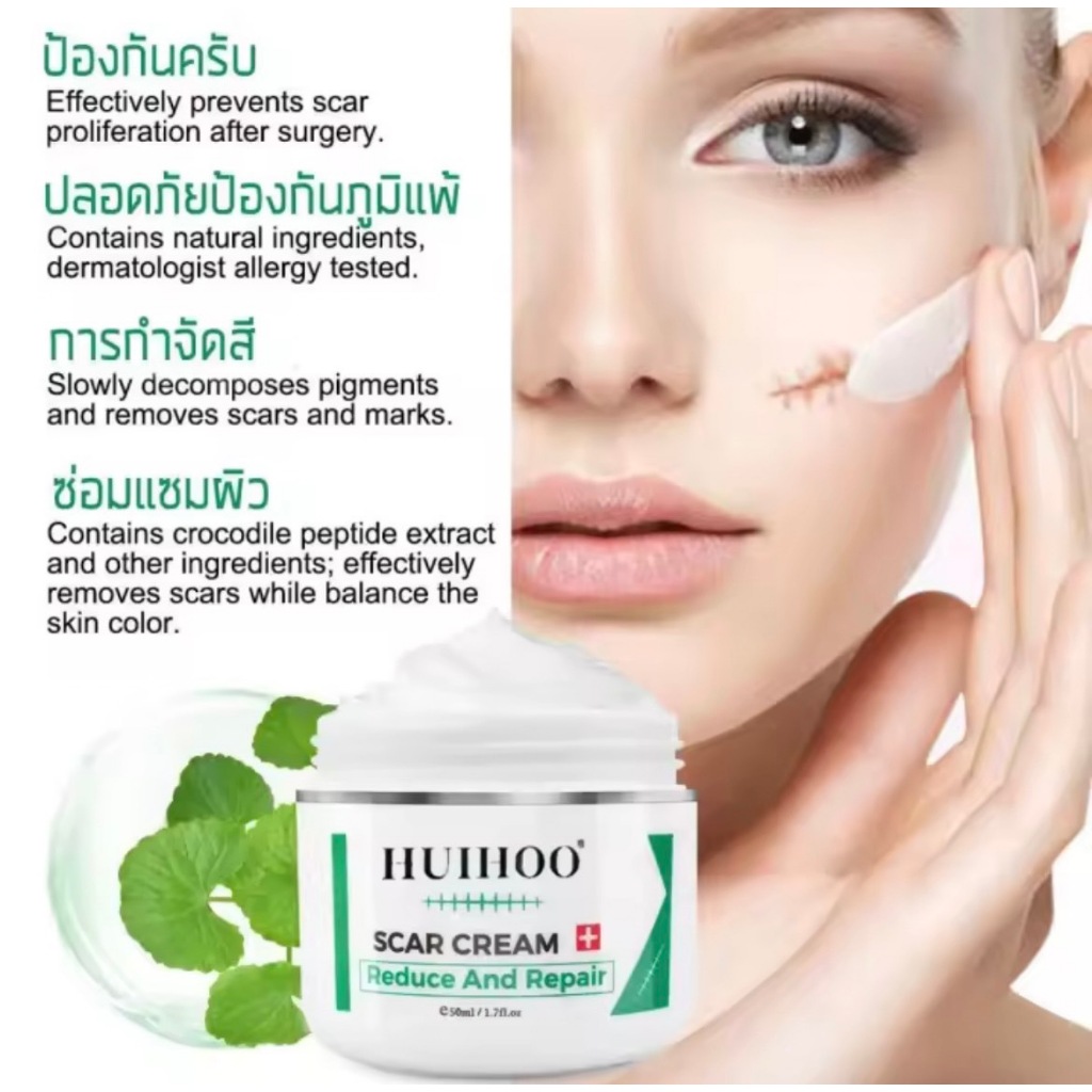 [พร้อมส่ง] HUIHOO ALIVER  Repair Scar ครีมลดรอยแผลเป็น ขาลาย ขาลายน้ำเหลือง  รอยแผลดำ  ลดรอยแผลเป็น