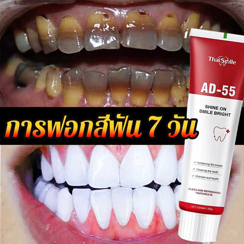 ซื้อ 1 แถม 1ยาสีฟันแก้ฟันเหลืองดับกลิ่นปาก ยาสีฟันไวท์เทนนิ่ง ดูแลช่องปาก ฟอกฟันขาว sp 4