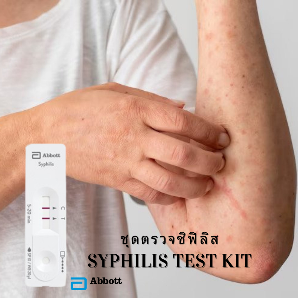 ชุดตรวจซิฟิลิสด้วยตนเอง ยี่ห้อ Bioline™ Syphilis 3.0 Bioline Syphilis 3.0 ความไวสูง
