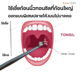 นิ่วทอลซิล อุปกรณ์กำจัดนิ่วทอมซิล ก้อนเหม็นในปากนิ่วทอนซิล อุปกรณ์ครบใช้ง่าย tonsil stone remover ไฟฉายมีถ่านให้ครบ NEW