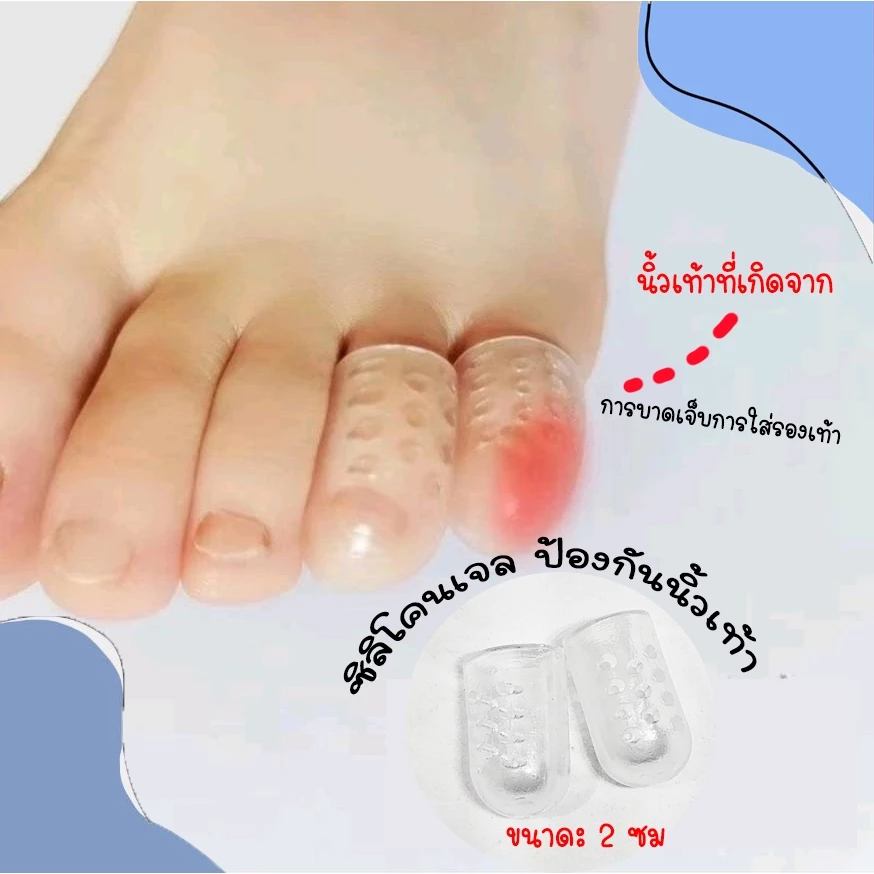 ซิลิโคนเจลป้องกันนิ้วเท้า /ฝาครอบนิ้วเท้า ระบายอากาศ /ป้องกันการเสียดสี /เล็บขบ 1ชิ้น