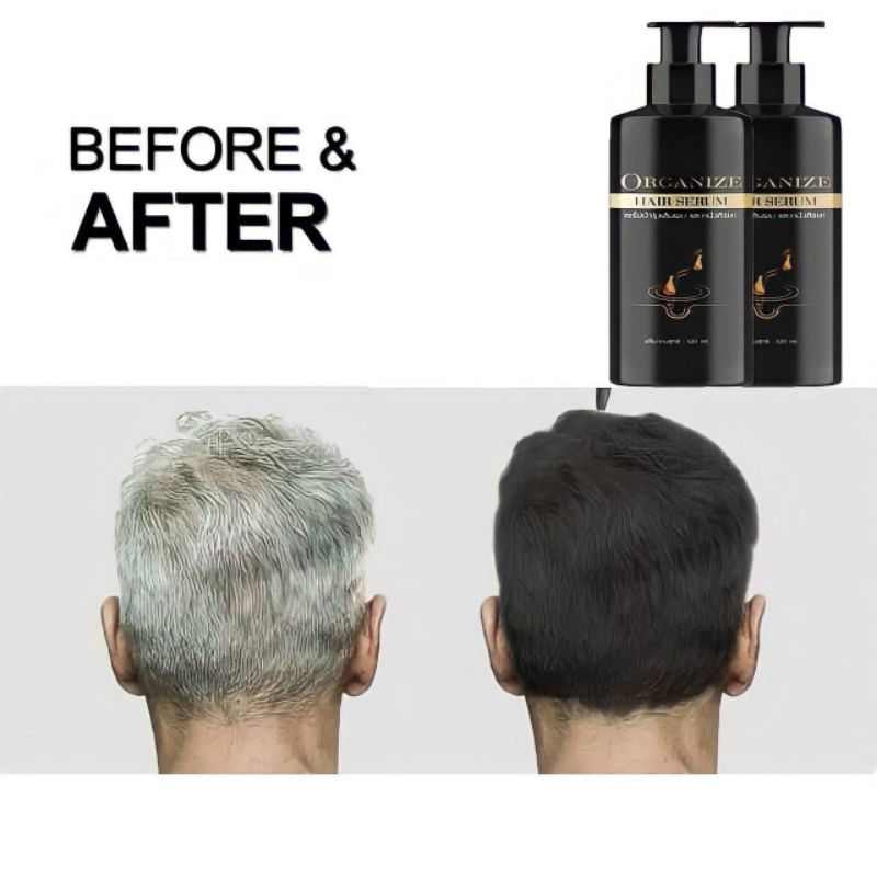 เซรั่มแก้ผมหงอก ป้องกันผมร่วง - รูปที่ 2