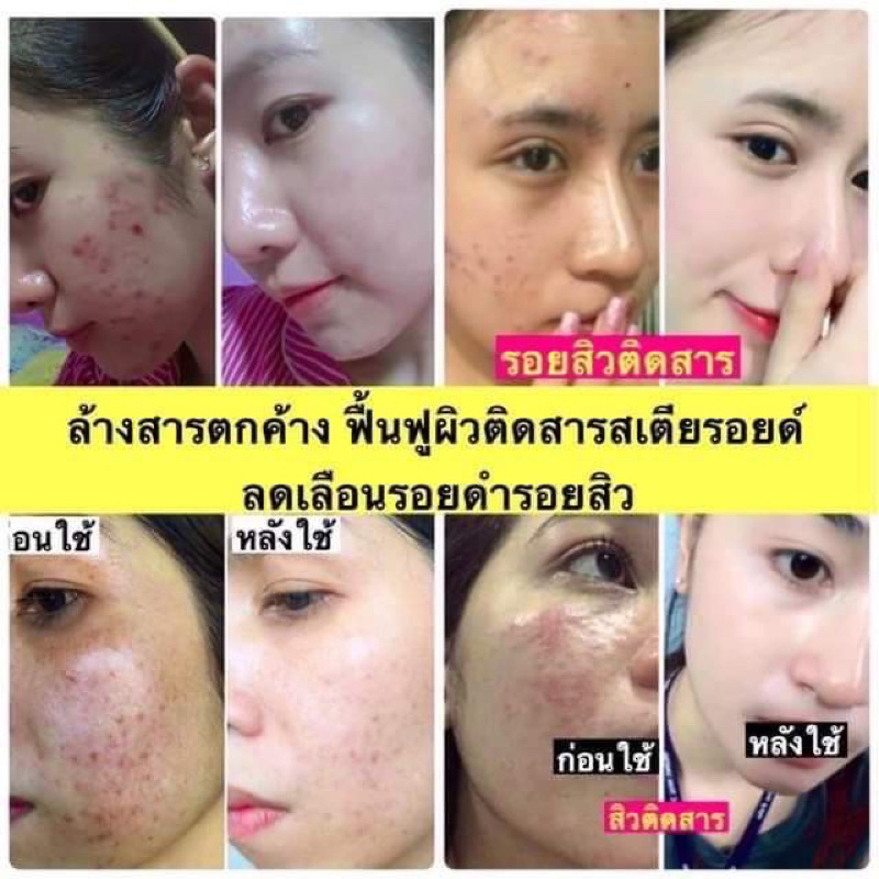 ⚡ของแท้💯 พร้อมส่ง⚡ CK ครีมแตงกวา ครีมฝ้า ครีมหน้าเงา ครีมฝ้า ครีมสิว ครีมหน้าเด้ง - รูปที่ 6