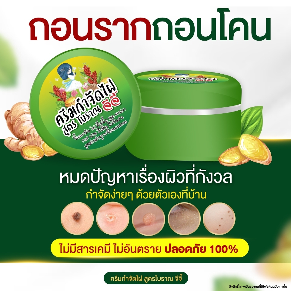 ครีมไฝจีจี้ ขี้แมลงวัน ติ่งเนื้อ หูด ตาปลา ไฝ แก้ปัญหา กระ สิวหิน ไฝ หูด จี้หูด แต้มไฝ
