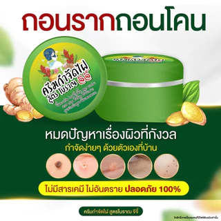 ครีมไฝจีจี้ ขี้แมลงวัน ติ่งเนื้อ หูด ตาปลา ไฝ แก้ปัญหา กระ สิวหิน ไฝ หูด จี้หูด แต้มไฝ