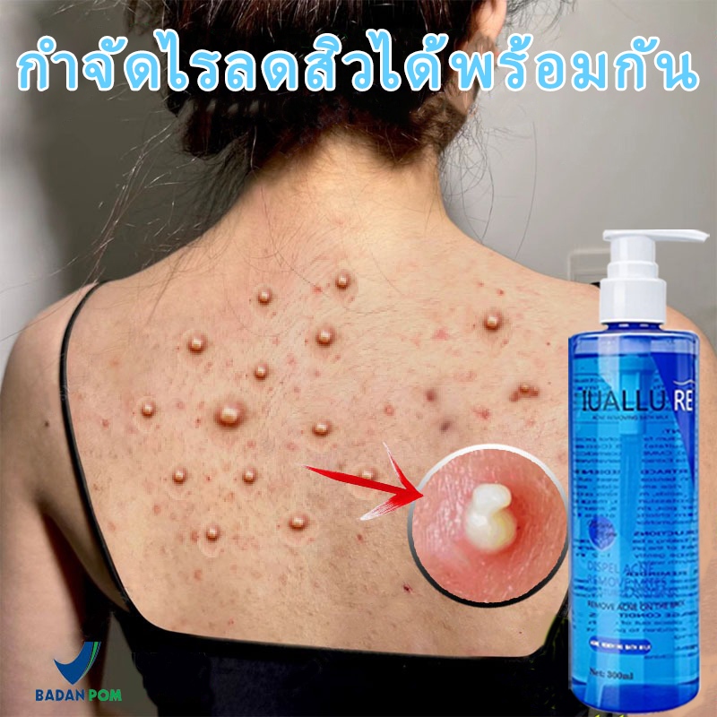 เจลอาบน้ำลดสิวหลัง กำจัดไร กลิ่นหอมติดทน อ่อนโยน ดับกลิ่นตัว คุมความมัน แก้สิวอุดตัน ใช้ได้ทั้งชาย–หญิง 300ml