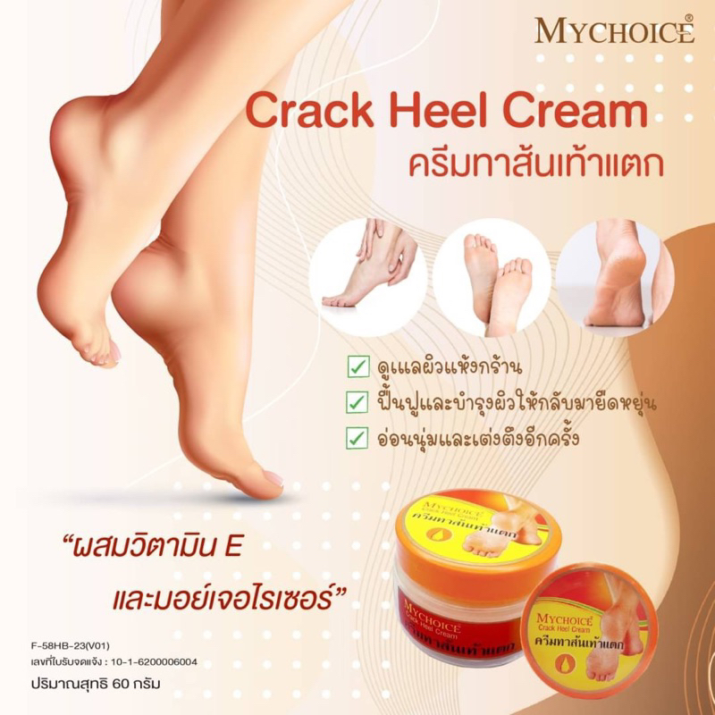 ครีมแก้ส้นเท้าแตก ครีมบำรุง​เท้า ครีมทาส้นเท้าแตกมายช้อยส์​ ครีมเท้าแตก ปริมาณ​ 60 กรัม