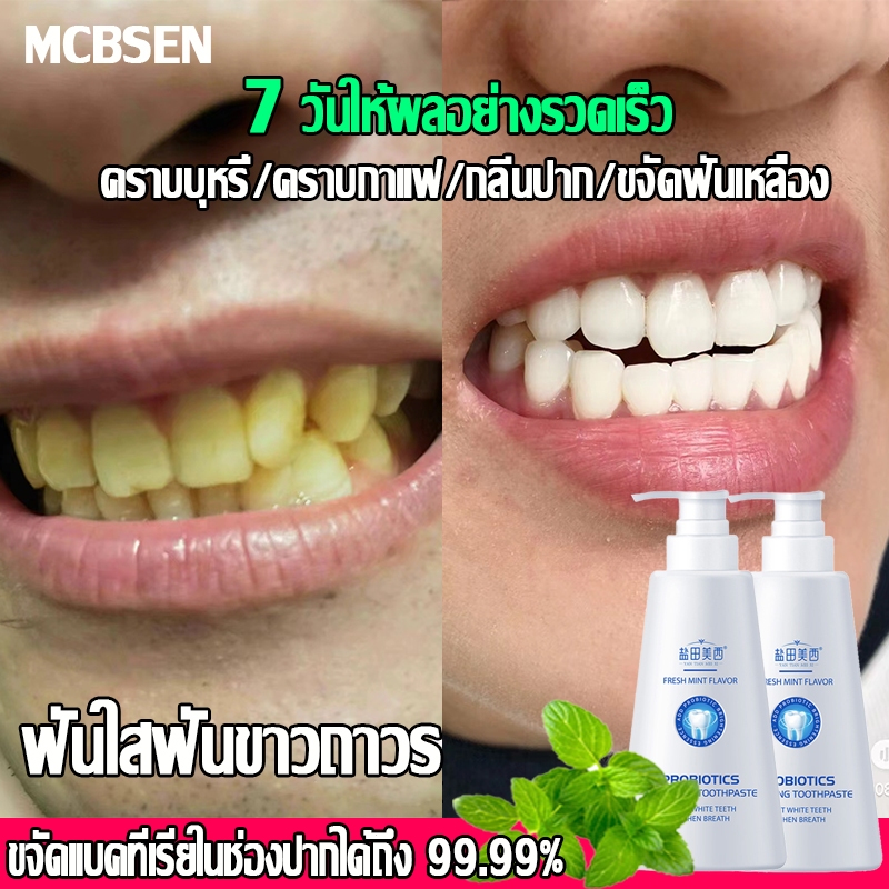 ฟันใสฟันขาวถาวร🦷ยาสีฟันไวท์เทนนิ่ง ยาสีฟัน ลดกลิ่นปาก ฟันผุฟันผุ คราบบุหรี่/คราบกาแฟ กําจัดแบคทีเรียในช่องปาก99.99%