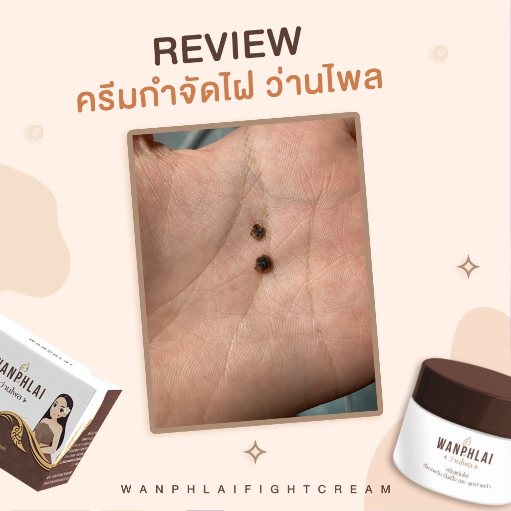 ครีมแต้มไฝ ว่านไพล ขี้แมลงวัน ติ่งเนื้อ หูด สิวหิน  แก้ปัญหา ตาปลา ครีมแต้มไฝ ว่านไพล ไฝ หูด จี้ไฝ - รูปที่ 7