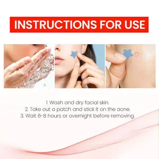 (มีส่งด่วน) JAYSUING PIMPLES PATCH แผ่นแปะสิว ลดจุดด่างดํา ซึมซับสิวอย่างอ่อนโยน 200 PATCHS