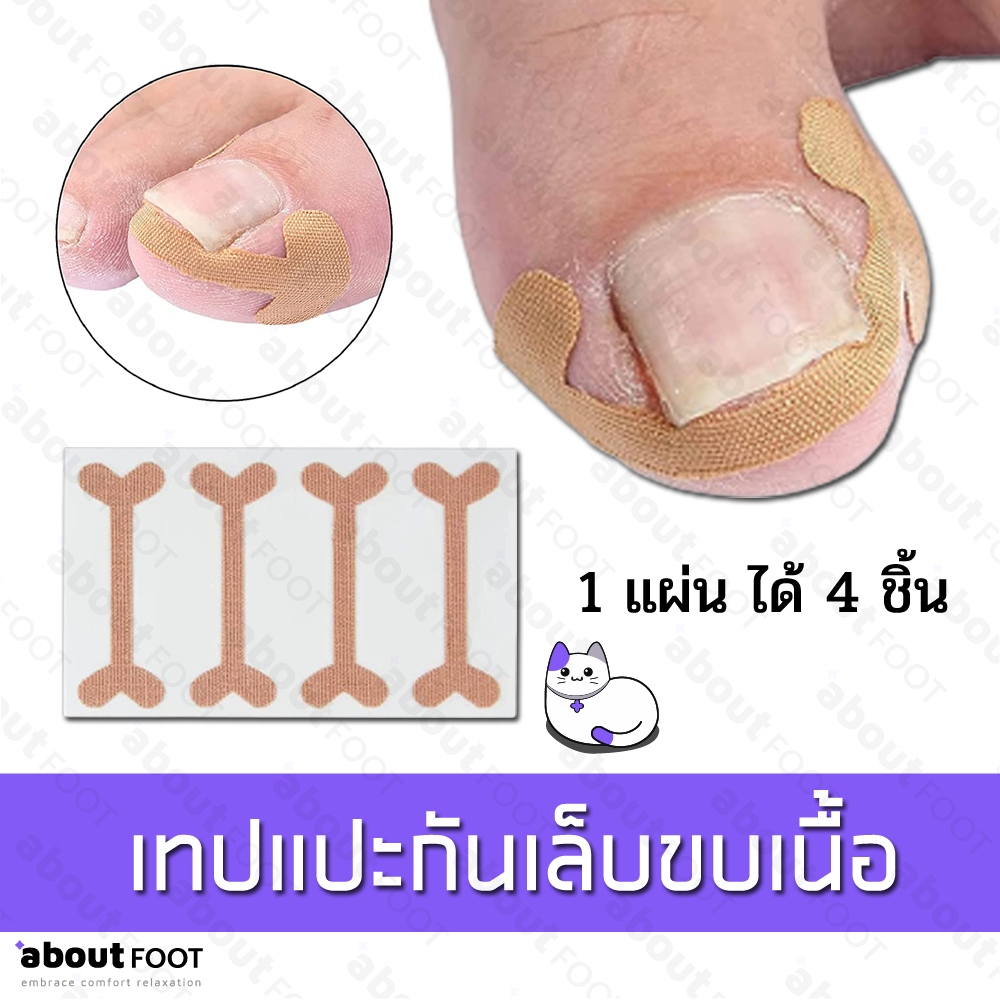 เทปแปะกันเล็บขบเนื้อ ลดอาการบาดเจ็บ จากเล็บขบ เทปพลาสเตอร์ติดกันเล็บขบ เล็บฝังลึกนิ้วเท้า 1แผ่น/4ชิ้น พร้อมจัดส่ง