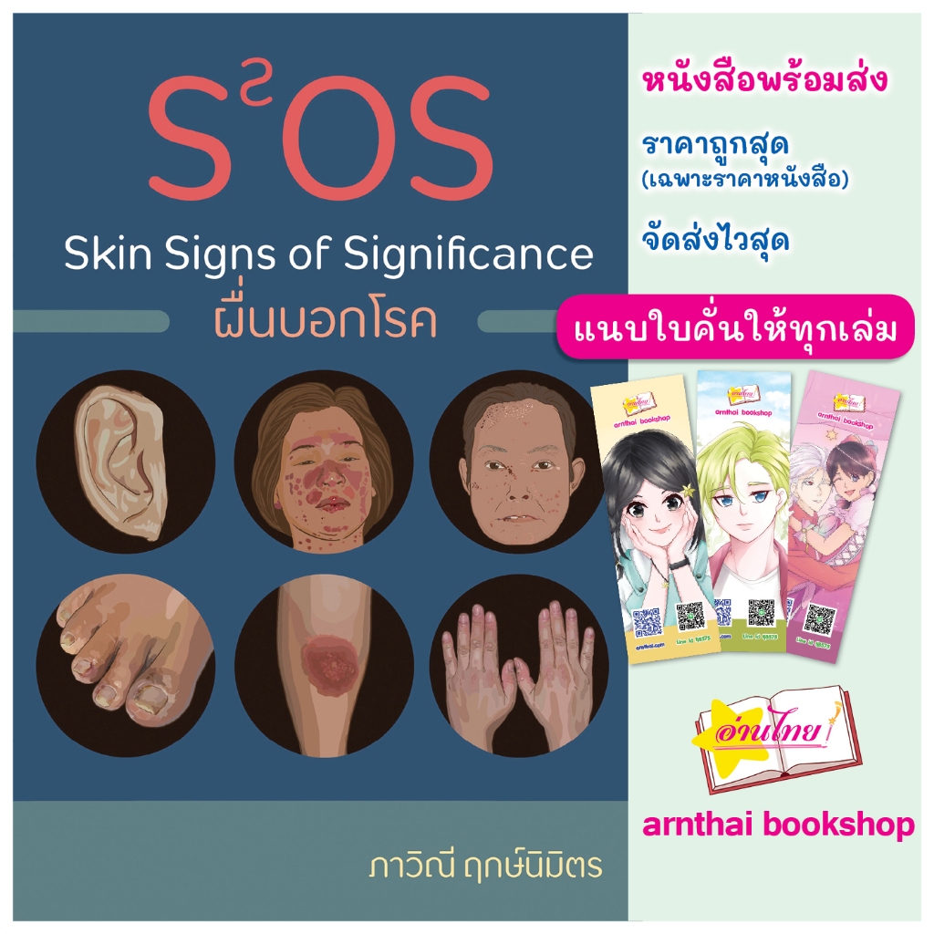 ผื่นบอกโรค Skin Signs of Significance