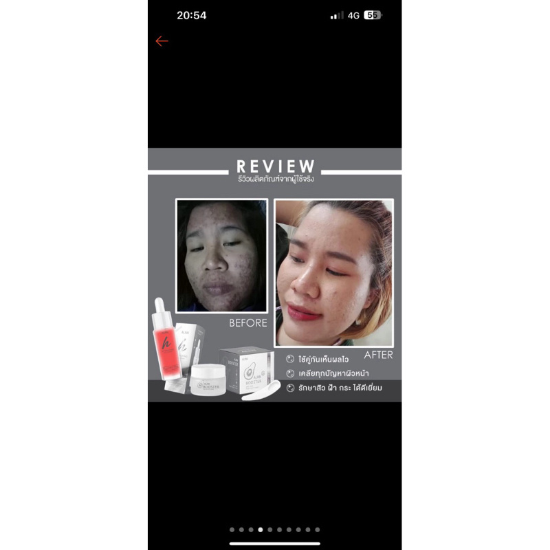 Alinbooster เซรั่มอลินบูทเตอร์ รูปที่ 5