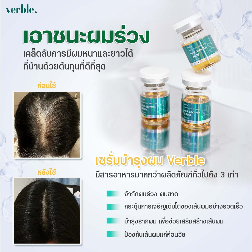 【2 กล่อง | 3 กล่อง】SET COMBO HAIR SERUM VERBLE | ปลูกผม ดูแลผม คืนความเสียหาย ลดการแตกปลาย เพิ่มกา